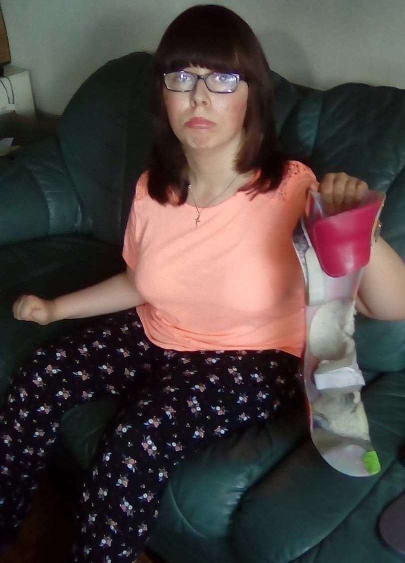 When your AFO is on its last legs